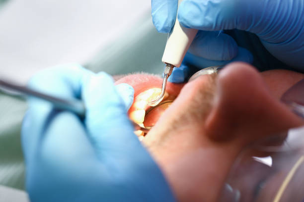 Best Pediatric Emergency Dentist in Vinco, PA