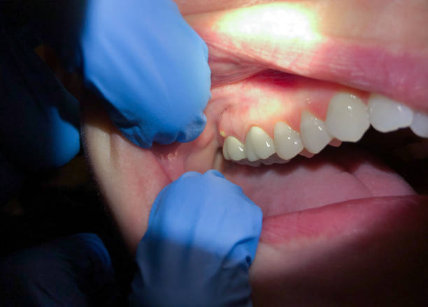 Best Broken or Cracked Tooth Emergency Dentist in Vinco, PA
